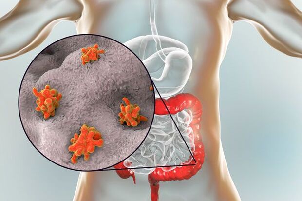 Видове паразити в човешкото тяло
