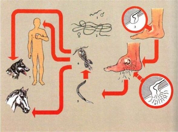 Развитие на дракункулеза